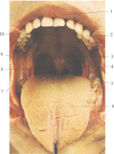 图3-37 恒牙牙示-口腔颌面及颈部临床解剖学-医学