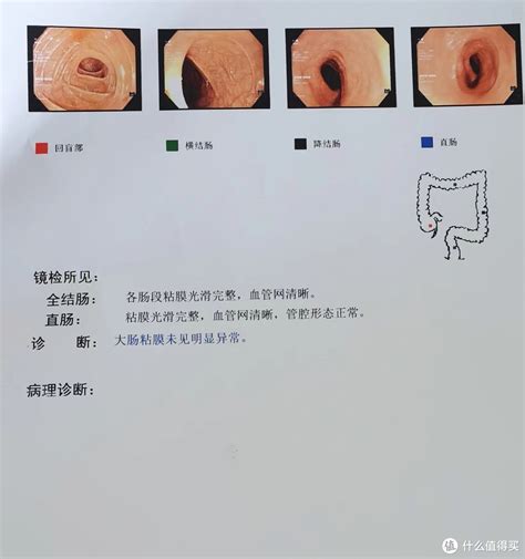 胃肠镜，守护健康的“利器”！ - 竹溪县人民医院官网