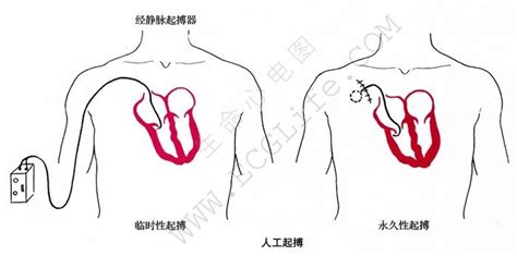 中国国产首例临时心脏起搏器获批上市。该产品是中国首例临时心脏起搏器，既可用于对心动过缓患者进行临时起搏，还可作为一台起搏系统分析仪使用，对起搏 ...