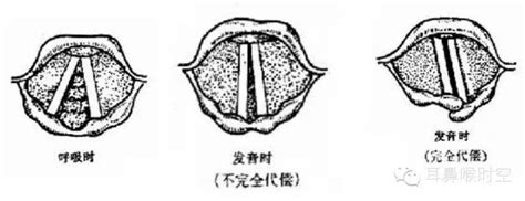 声带图片