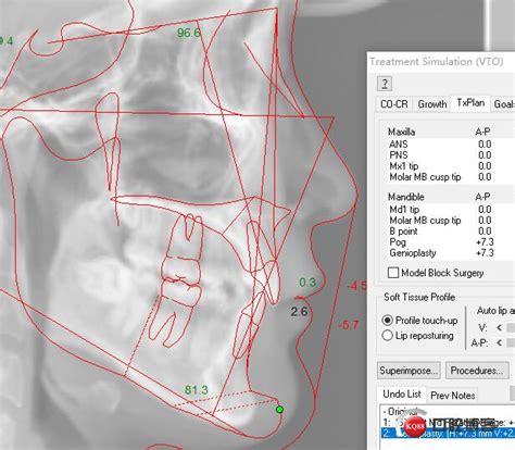 3DBody3.0简化版|3DBody三维免费人体解剖软件 V3.0 永生免费版下载_当下软件园