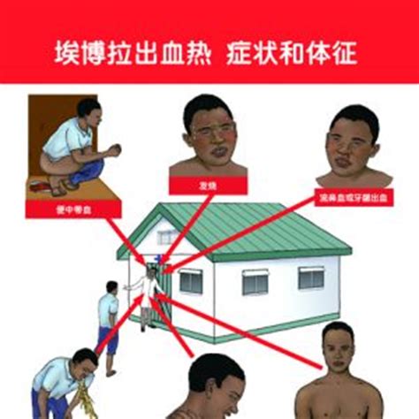 埃博拉病毒归档 - 92电影解说网