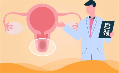 一篇文章，看懂宫颈癌TCT检查的10种结果！|宫颈癌|HPV_新浪新闻