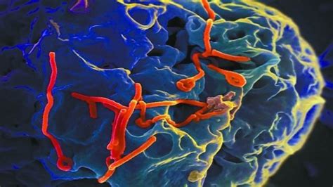 埃博拉病毒疫苗研制迫在眉睫----中国科学院科技战略咨询研究院