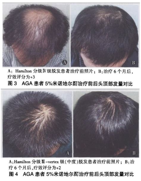 【图】头发多久做一次营养比较好 根据具体情况来判断_头发多_女物美容网|nvwu.com