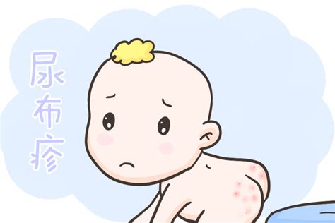 婴儿尿布疹初期图片（十个宝宝八个都会患上尿布疹）-幼儿百科-魔术铺