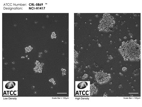 NCTC clone 929(L929)_细胞株_宁波明舟生物科技有限公司，细胞，菌株 ，ATCC，保藏中心