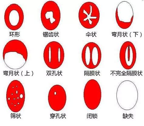 处女膜实图图片