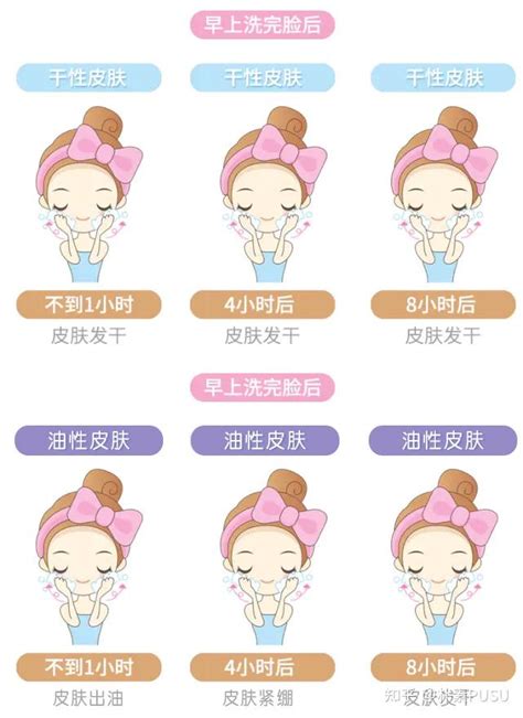 类型图片
