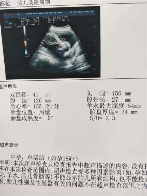 奥特曼b超单图片