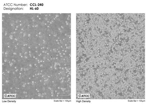 HL-60细胞ATCC CCL-240细胞 HL60人原髓细胞白血病细胞株购买价格、培养基、培养条件、细胞图片、特征等基本信息_生物风