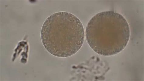 显微镜下的精子与卵细胞