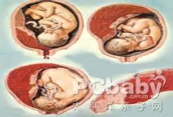 孕期出现某些情况表示胎儿缺氧了，孕妈一定要重视哪种情况呢？|胎动_新浪新闻