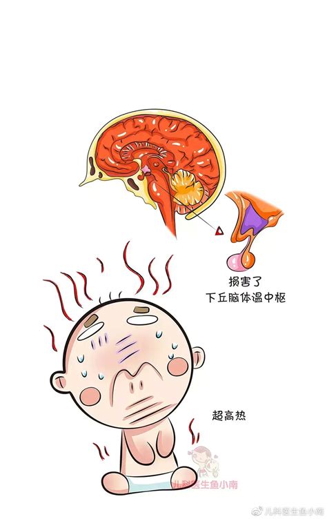 脑子生锈了图片