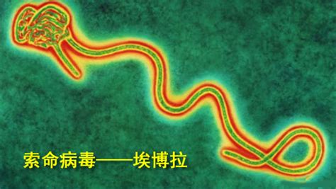 以色列公司Protalix：可生产埃博拉实验药物ZMapp-观察-生物探索