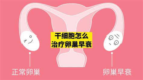 “卵巢早衰”是怎么一回事？怎样延缓卵巢衰老? - 知乎