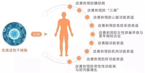 日本干细胞-干细胞疗法干预阿尔茨海默病的3大机理_多睦健康海外高端医疗