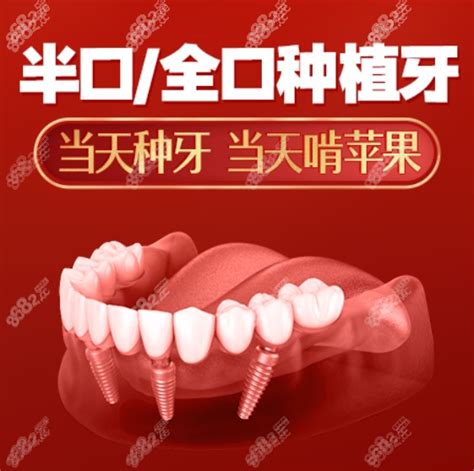 南通口腔医院收费标准里有南通做一颗种植牙的价格,真不贵,牙齿对比照片-8682赴韩整形网