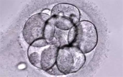 试管婴儿移植了优质胚胎，为何还是失败了？ - 知乎