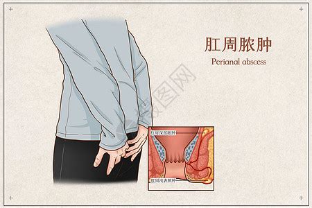 臀部及肛门图片免费下载_PNG素材_编号1l0ix6we4_图精灵