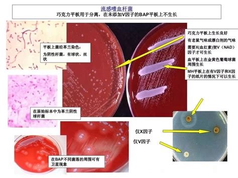 副猪嗜血杆菌的致病机制 | 中国动物保健·官网