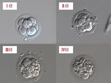 胚胎质量等级对照表详解，差的也有移植价值_家庭医生在线