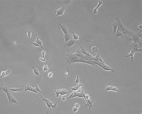 TTP对小鼠乳腺癌细胞系4T1凋亡的调控