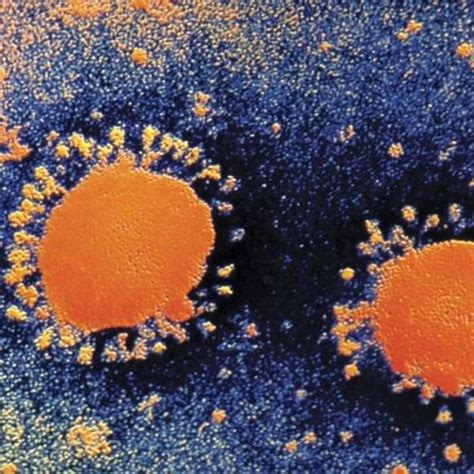 突变的新冠病毒：感染性增强3至9倍，从欧洲传到美国_凤凰网