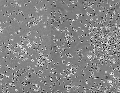 AC16细胞（细胞培养基、血清 AC16细胞实验）_环保在线
