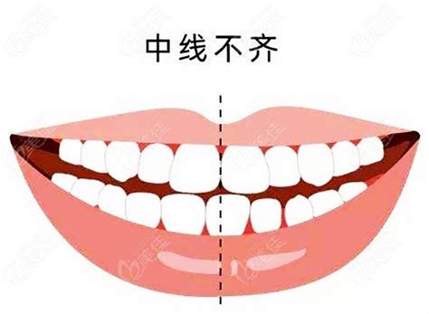 十字牙位图图片