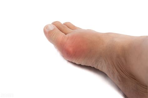 脚底疼痛部位图解，最常见的足底筋膜炎是脚后跟疼 — 神奇养生网