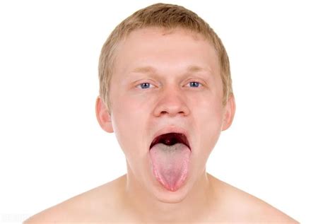 5种常见舌相学起来，出现第四种需要及时就医！_舌头