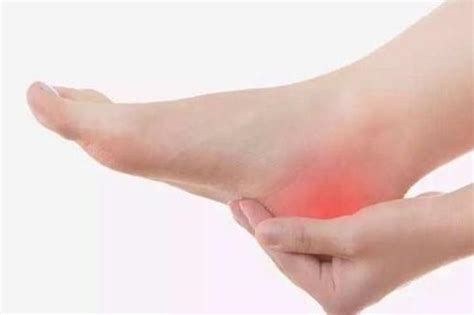 足底筋膜炎：脚后跟疼，简单3步，和疼痛说再见