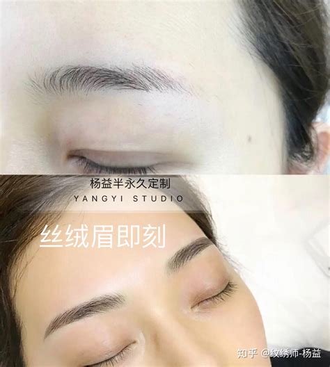 美莱纹眉术 不化妆拥有自然眉形_上海美莱医疗美容【官网】