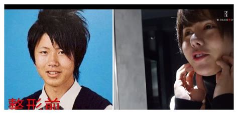日本男公关为出名疯狂整容，整张脸99%动过刀，整容前后照片曝光__凤凰网