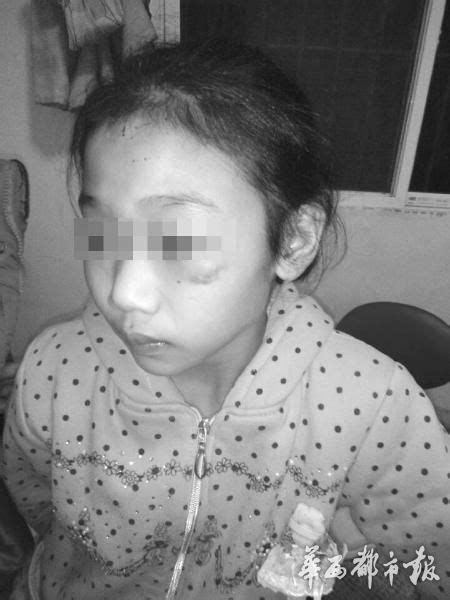 四川11岁女孩被刀割针扎满身伤 警方刑拘养父母_中国网教育|中国网