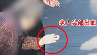 上海一女子吵架后从三楼扔酒瓶，砸伤九旬老人致其头部出血_关键帧_澎湃新闻-The Paper