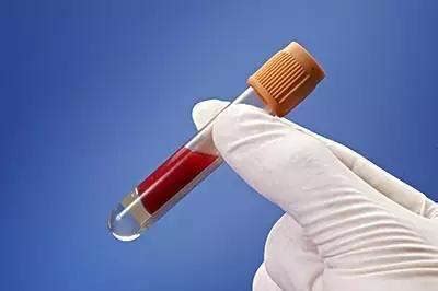 怎样看懂血常规检查报告单?-如何看血常规化验单
