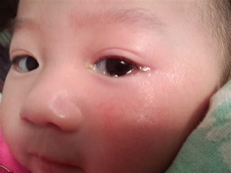 婴儿流泪（宝宝眼泪汪汪）-幼儿百科-魔术铺