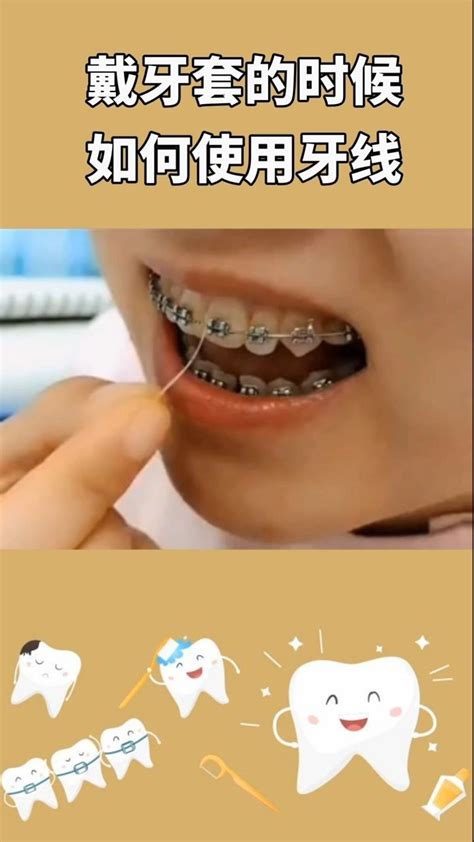 戴牙套的宝宝们，你知道戴牙套的时候如何使用牙线吗？