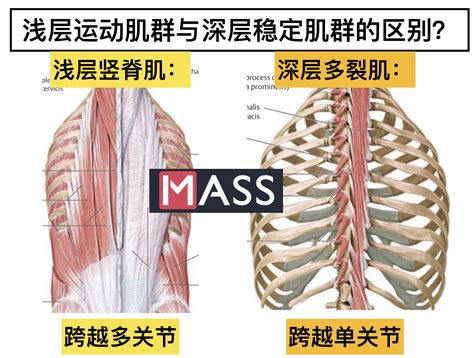 多裂肌的位置图图片