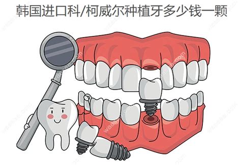 韩国进口科/柯威尔种植牙多少钱一颗,cowell亲水植体价格7000+ - 口腔资讯 - 牙齿矫正网