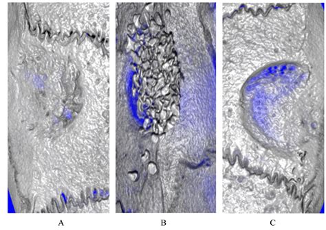 NIH Public Access | 大鼠颅骨临界大小缺损对骨再生的影响_支架