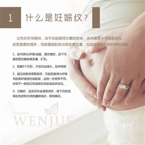纹爵妊娠纹项目手册|平面|宣传品|mafengjin7823 - 原创作品 - 站酷 (ZCOOL)