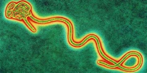 埃博拉病毒的传播途径_360新知