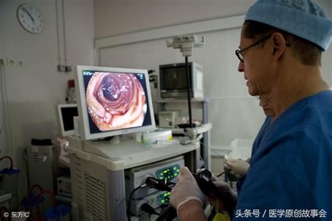 做肠镜检查时发现了几个小息肉,为什么医生当时不给切除？ - 知乎