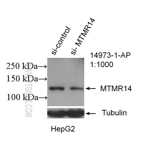 MTMR14 Antibody 14973-1-AP | Proteintech