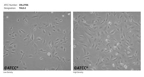 Hep-G2/C3A细胞ATCC CRL-10741细胞 C3A人肝癌细胞株购买价格、培养基、培养条件、细胞图片、特征等基本信息_生物风