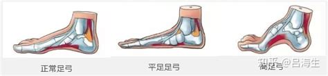 人体解剖模型_正常 弓型足 模型 足部病理模型足部解剖脚关节 - 阿里巴巴