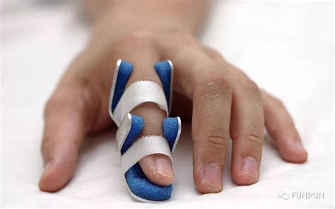 手指戳伤如何恢复避免关节变粗？|手指|关节|受伤_新浪新闻